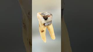 CACHE TOI PARMI LES DENTS RESTANTES DE THEKAIRI78 ! 😨 #shorts