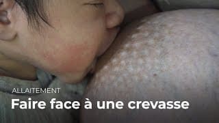 Faire face à une crevasse | Allaitement