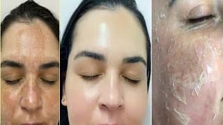 أقوي وصفه لتبييض تخلي وجهك وجسمك كيف المرايا بياض كاثلج 😌🌸