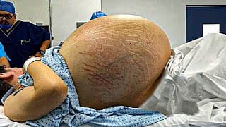 ELLE PENSE QU’ELLE VA AVOIR DES JUMEAUX : PUIS LE DOCTEUR DÉCOUVRE QUELQUE CHOSE D’INCROYABLE