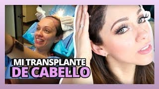 MI TRANSPLANTE DE CABELLO | HAIR TRANSPLANT SURGERY | #RosyStoryTime