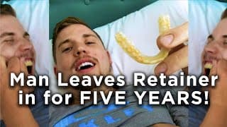 MAN LEAVES RETAINER IN for 5 YEARS! - Viral Fleeting Films Channels Video