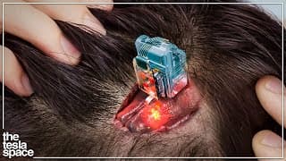 New Brain Implant Begins Human Trials - Neuralink Update!