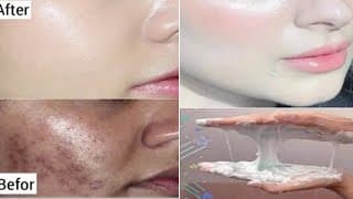 أقوي وصفه لتبييض تخلي وجهك وجسمك كيف المرايا بياض كاثلج