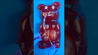 Will The World's Biggest Gummy Bear Survive a 36 Baby C-Section? 😭💔🤧🐻 #foodsurgery #satisfying #asmr