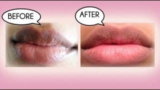 How to Lighten Dark Lips Naturally