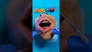 Why Are Among US Crewmates in Mr Kiwi's Mouth?? 👄😭 #MrKiwi #foodsurgery #discountdentist