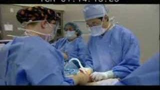 TV Made Me Do It - Tummy Tuck Abdominoplasty in Detroit Michigan with Dr. Youn