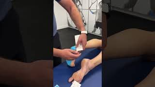 Taping for plantar fasciitis with Spidertech i-Strips
