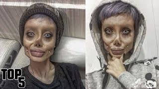 5 People Who Turned Themselves Into Plastic