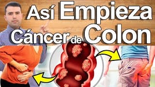 Así Empieza El Cáncer De Colon Y Nadie Lo Sabe - Signos Y Síntomas de Cáncer Que Debes Conocer