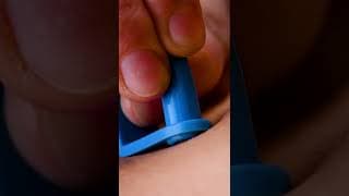 Useful skin tag remover #shorts