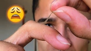 WHEN YOU PULL A HANGNAIL