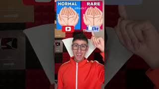 NORMAL VS RARE 🙌