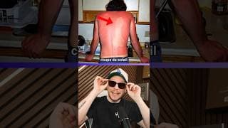 Les Coups de Soleils les plus Drôles