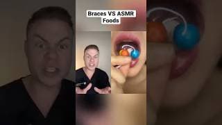 ASMR Foods VS Braces!