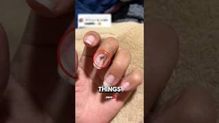 أوساخ الأظافر 💅 تحت المجهر 😱