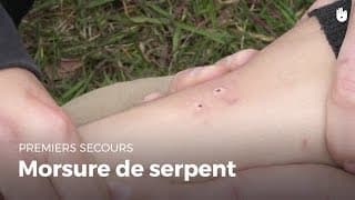 Premiers secours : Morsure de serpent | Secourisme